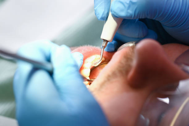 Best Emergency Treatment for Toothache in Trenton, MO