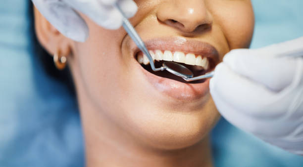 Best Emergency Tooth Extraction in Trenton, MO